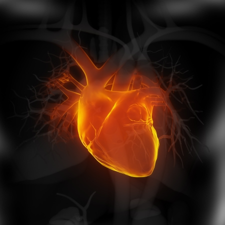 What is a nuclear stress test?